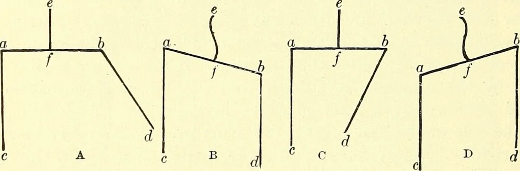An illustration from Modern surgery, general and operative / by John Chalmers Da Costa., 1907, leaf 570