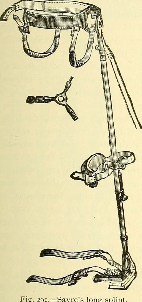 An illustration from Modern surgery, general and operative / by John Chalmers Da Costa., 1907, leaf 573