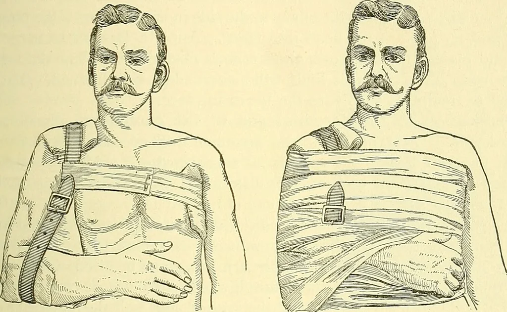An illustration from Modern surgery, general and operative / by John Chalmers Da Costa., 1907, leaf 603