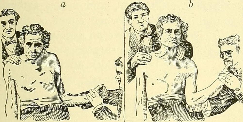 An illustration from Modern surgery, general and operative / by John Chalmers Da Costa., 1907, leaf 609