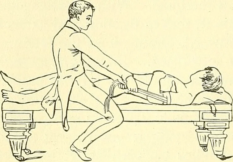 An illustration from Modern surgery, general and operative / by John Chalmers Da Costa., 1907, leaf 610