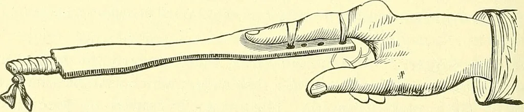 An illustration from Modern surgery, general and operative / by John Chalmers Da Costa., 1907, leaf 616