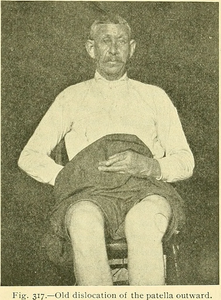 An illustration from Modern surgery, general and operative / by John Chalmers Da Costa., 1907, leaf 623