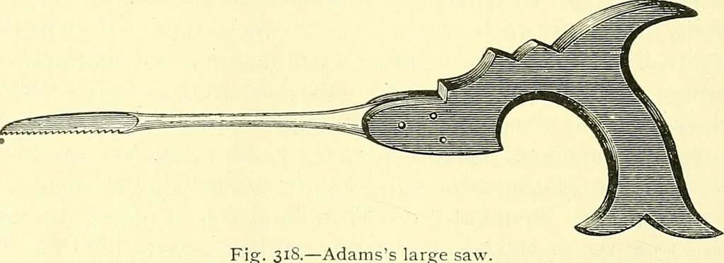 An illustration from Modern surgery, general and operative / by John Chalmers Da Costa., 1907, leaf 628