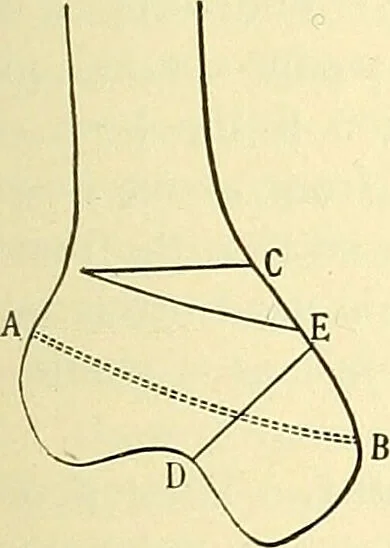 An illustration from Modern surgery, general and operative / by John Chalmers Da Costa., 1907, leaf 629