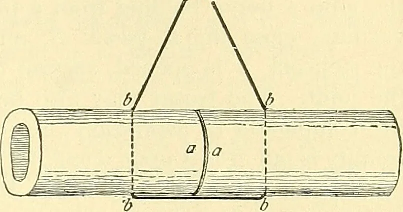 An illustration from Modern surgery, general and operative / by John Chalmers Da Costa., 1907, leaf 637