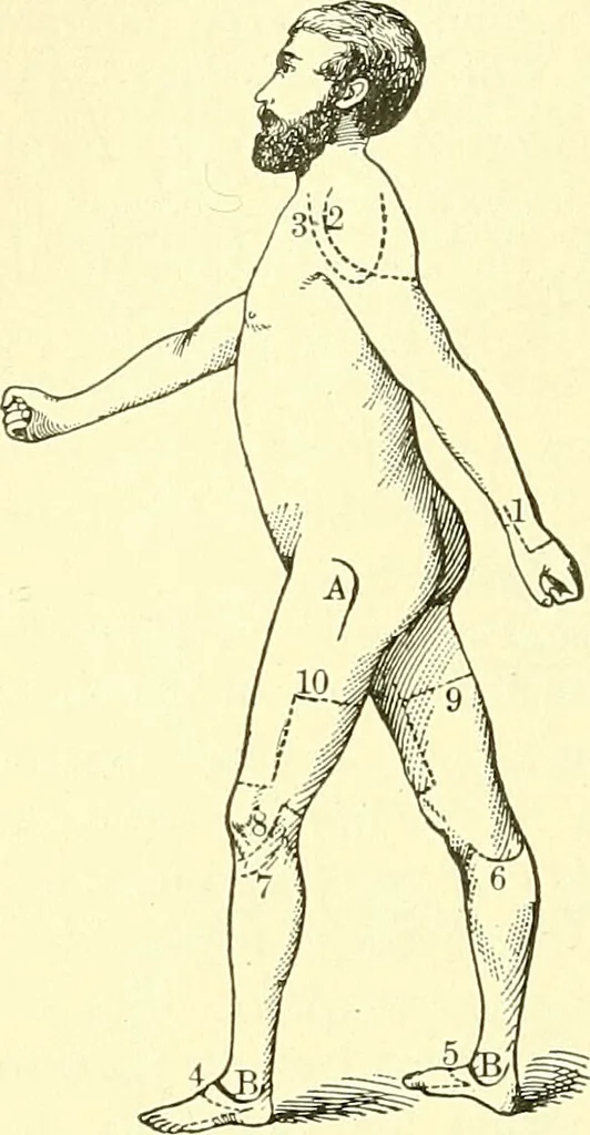 An illustration from Modern surgery, general and operative / by John Chalmers Da Costa., 1907, leaf 640