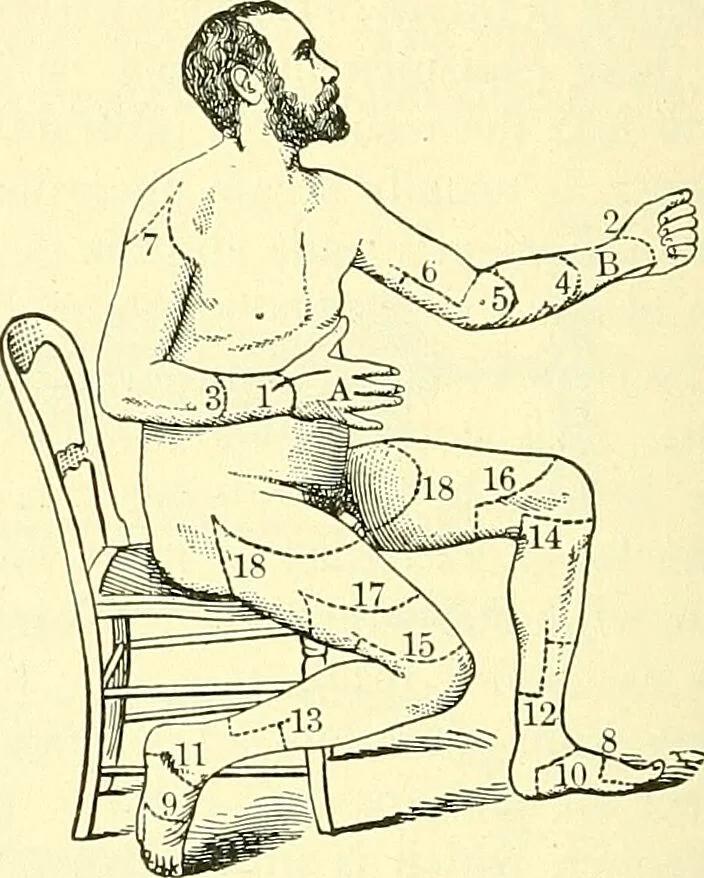 An illustration from Modern surgery, general and operative / by John Chalmers Da Costa., 1907, leaf 640
