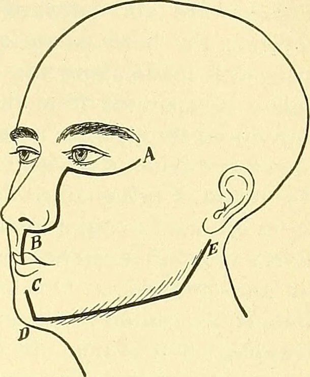 An illustration from Modern surgery, general and operative / by John Chalmers Da Costa., 1907, leaf 651