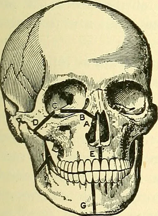 An illustration from Modern surgery, general and operative / by John Chalmers Da Costa., 1907, leaf 651