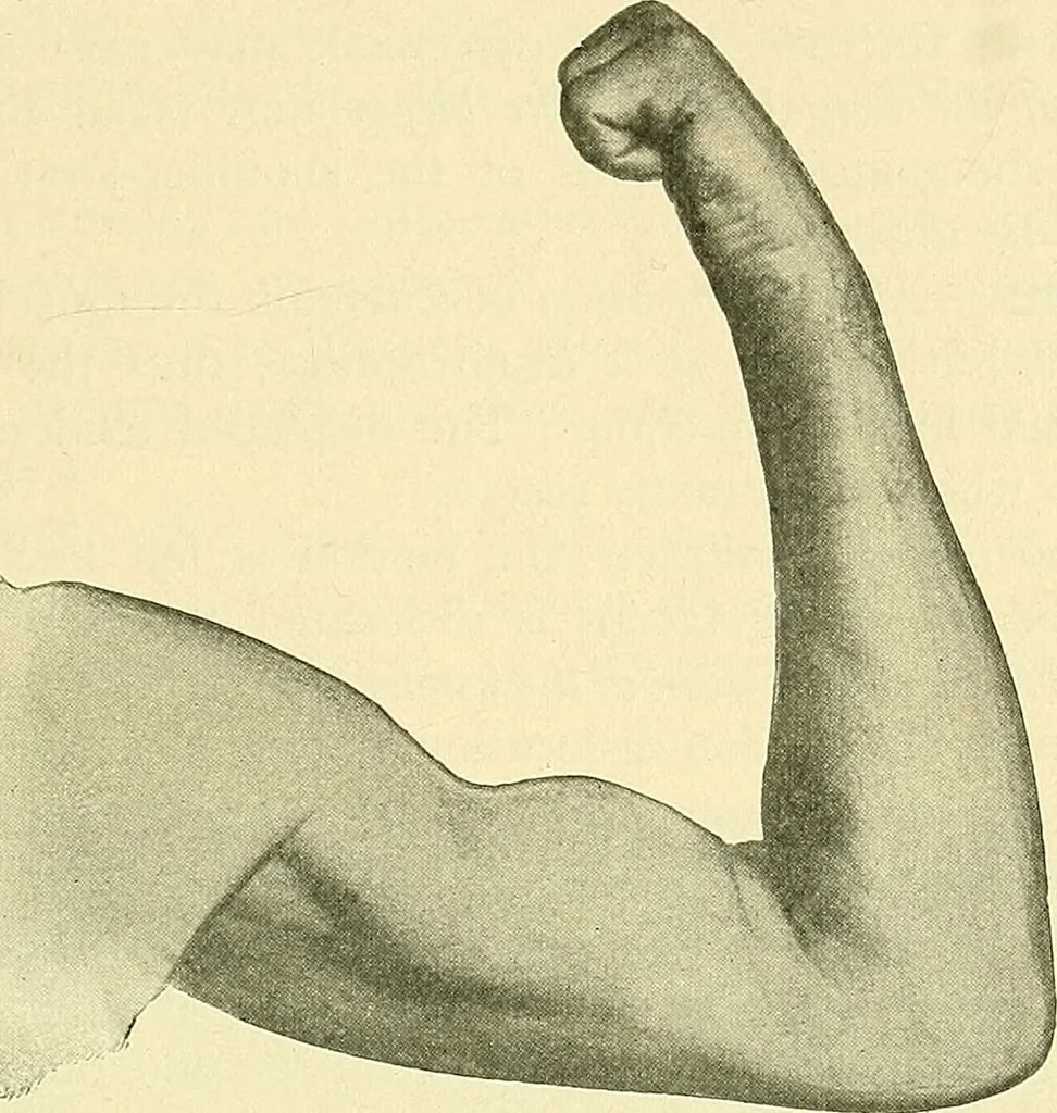 An illustration from Modern surgery, general and operative / by John Chalmers Da Costa., 1907, leaf 661