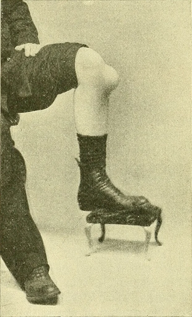 An illustration from Modern surgery, general and operative / by John Chalmers Da Costa., 1907, leaf 671