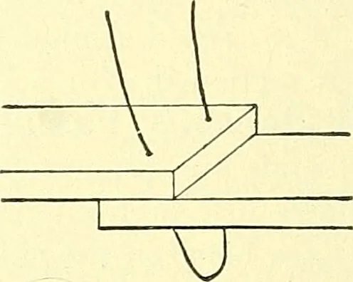 An illustration from Modern surgery, general and operative / by John Chalmers Da Costa., 1907, leaf 674