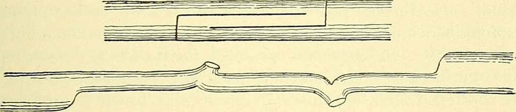 An illustration from Modern surgery, general and operative / by John Chalmers Da Costa., 1907, leaf 675