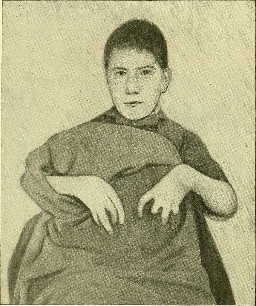 An illustration from Modern surgery, general and operative / by John Chalmers Da Costa., 1907, leaf 679