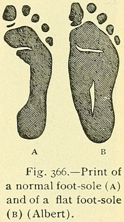 An illustration from Modern surgery, general and operative / by John Chalmers Da Costa., 1907, leaf 681