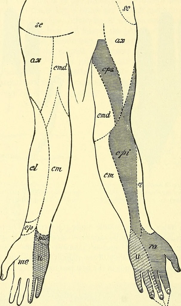 An illustration from Modern surgery, general and operative / by John Chalmers Da Costa., 1907, leaf 690