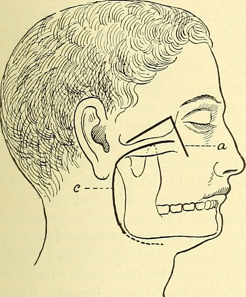 An illustration from Modern surgery, general and operative / by John Chalmers Da Costa., 1907, leaf 699