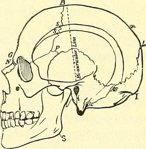 An illustration from Modern surgery, general and operative / by John Chalmers Da Costa., 1907, leaf 704