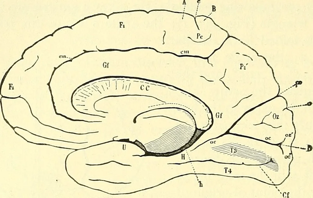 An illustration from Modern surgery, general and operative / by John Chalmers Da Costa., 1907, leaf 706
