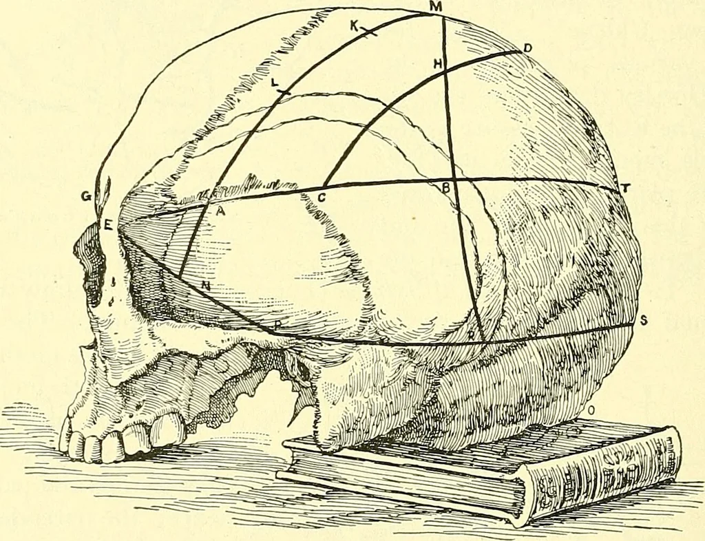 An illustration from Modern surgery, general and operative / by John Chalmers Da Costa., 1907, leaf 706
