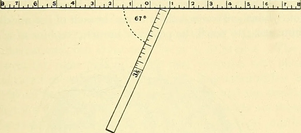 An illustration from Modern surgery, general and operative / by John Chalmers Da Costa., 1907, leaf 707