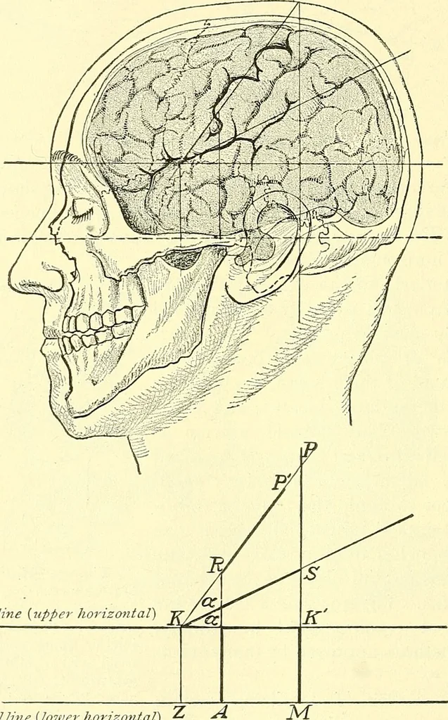 An illustration from Modern surgery, general and operative / by John Chalmers Da Costa., 1907, leaf 708