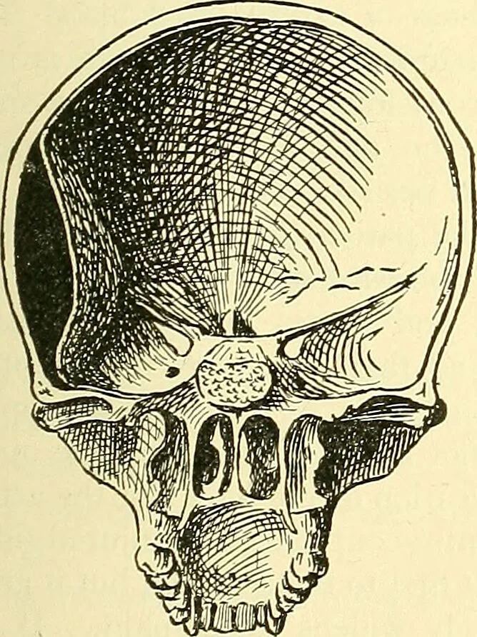 An illustration from Modern surgery, general and operative / by John Chalmers Da Costa., 1907, leaf 721