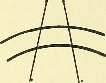 An illustration from Modern surgery, general and operative / by John Chalmers Da Costa., 1907, leaf 723