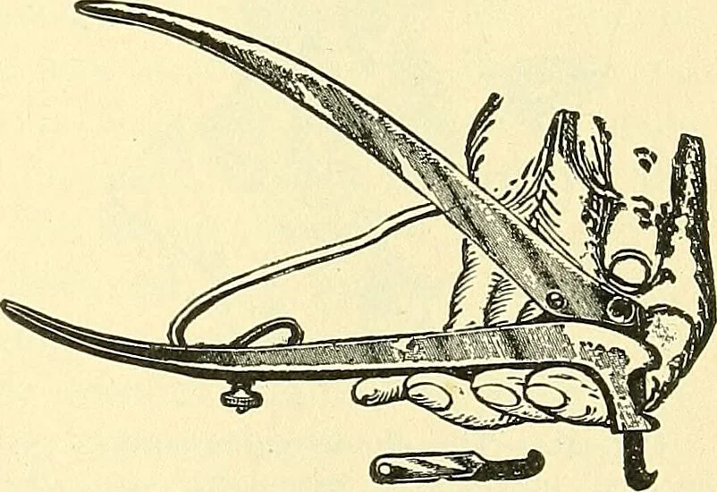 An illustration from Modern surgery, general and operative / by John Chalmers Da Costa., 1907, leaf 753