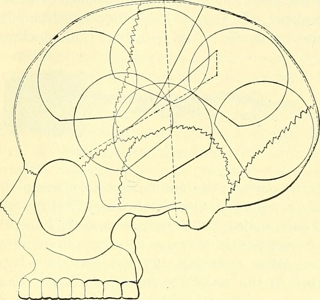 An illustration from Modern surgery, general and operative / by John Chalmers Da Costa., 1907, leaf 754