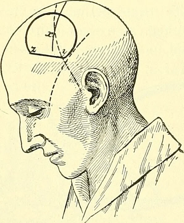 An illustration from Modern surgery, general and operative / by John Chalmers Da Costa., 1907, leaf 754