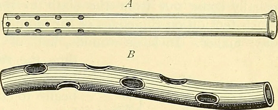 An illustration from Modern surgery, general and operative / by John Chalmers Da Costa., 1907, leaf 77
