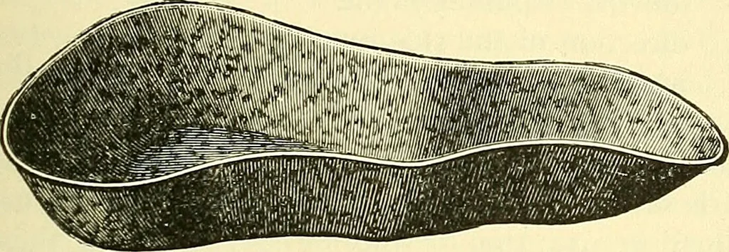 An illustration from Modern surgery, general and operative / by John Chalmers Da Costa., 1907, leaf 77