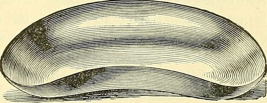 An illustration from Modern surgery, general and operative / by John Chalmers Da Costa., 1907, leaf 77