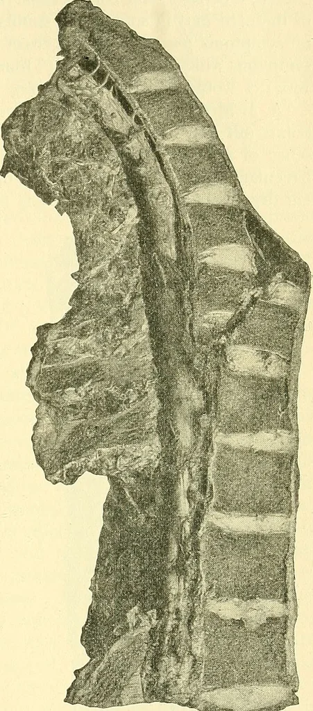 An illustration from Modern surgery, general and operative / by John Chalmers Da Costa., 1907, leaf 775