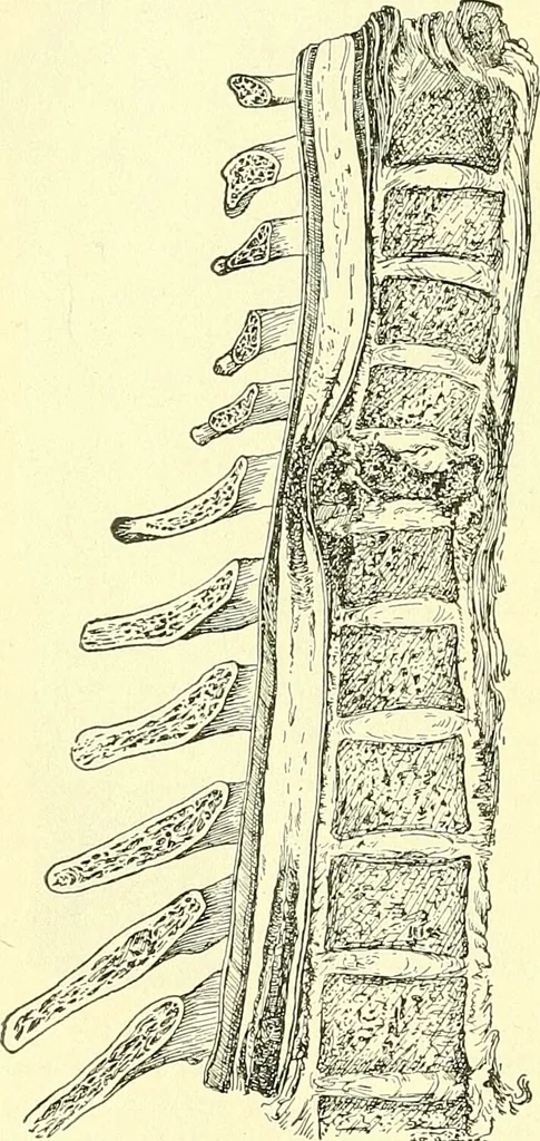 An illustration from Modern surgery, general and operative / by John Chalmers Da Costa., 1907, leaf 776