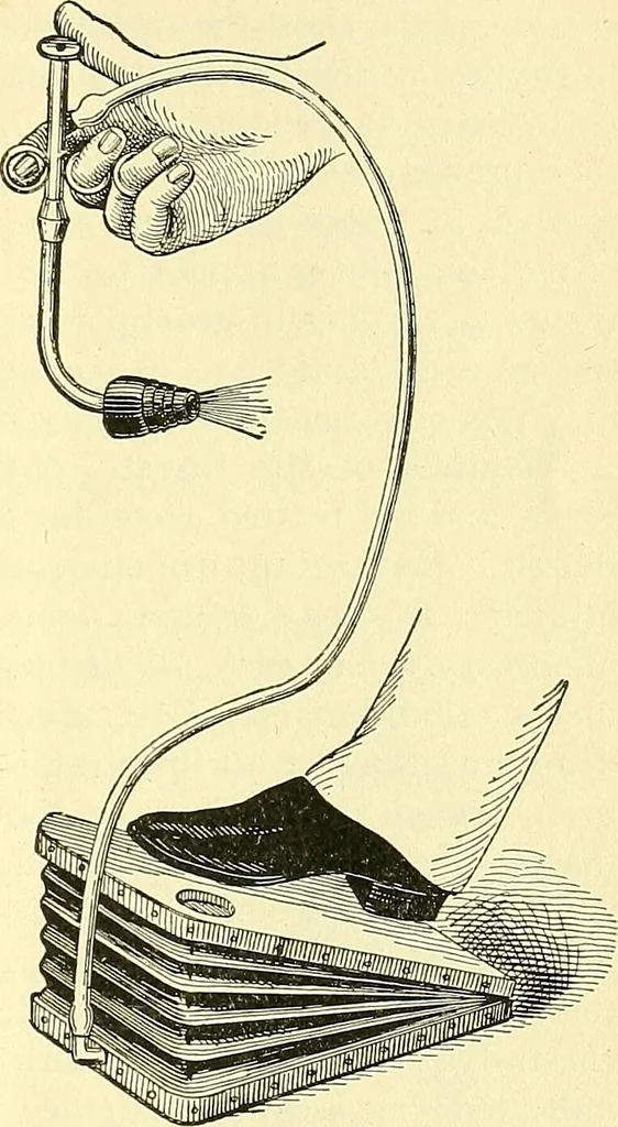 An illustration from Modern surgery, general and operative / by John Chalmers Da Costa., 1907, leaf 795