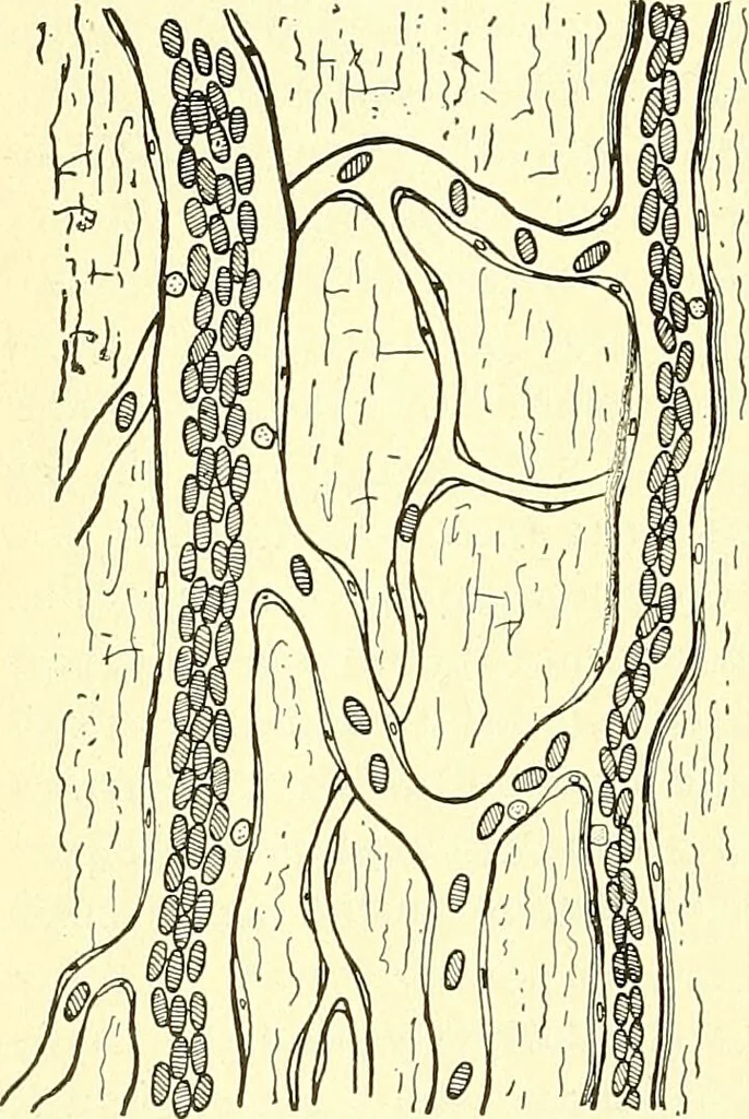 An illustration from Modern surgery, general and operative / by John Chalmers Da Costa., 1907, leaf 80