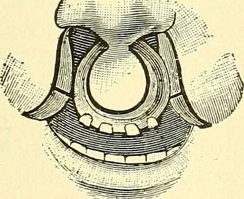 An illustration from Modern surgery, general and operative / by John Chalmers Da Costa., 1907, leaf 809