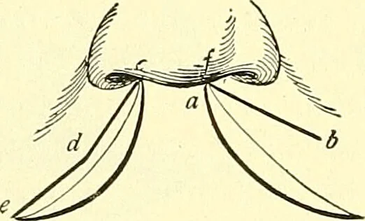 An illustration from Modern surgery, general and operative / by John Chalmers Da Costa., 1907, leaf 810