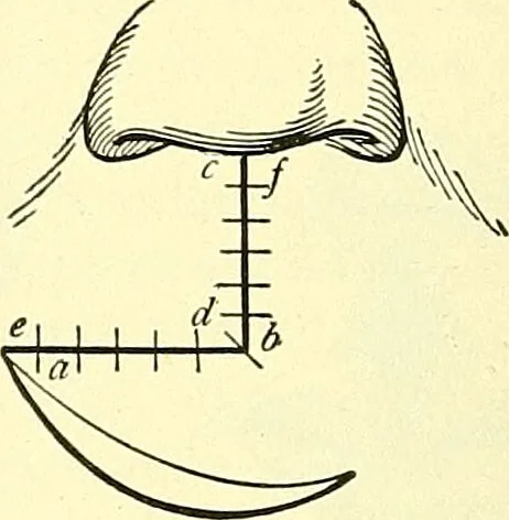 An illustration from Modern surgery, general and operative / by John Chalmers Da Costa., 1907, leaf 810