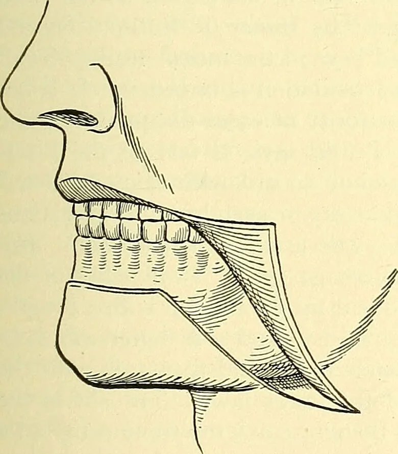 An illustration from Modern surgery, general and operative / by John Chalmers Da Costa., 1907, leaf 815