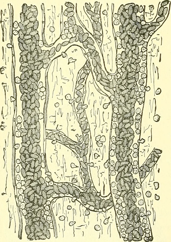 An illustration from Modern surgery, general and operative / by John Chalmers Da Costa., 1907, leaf 82