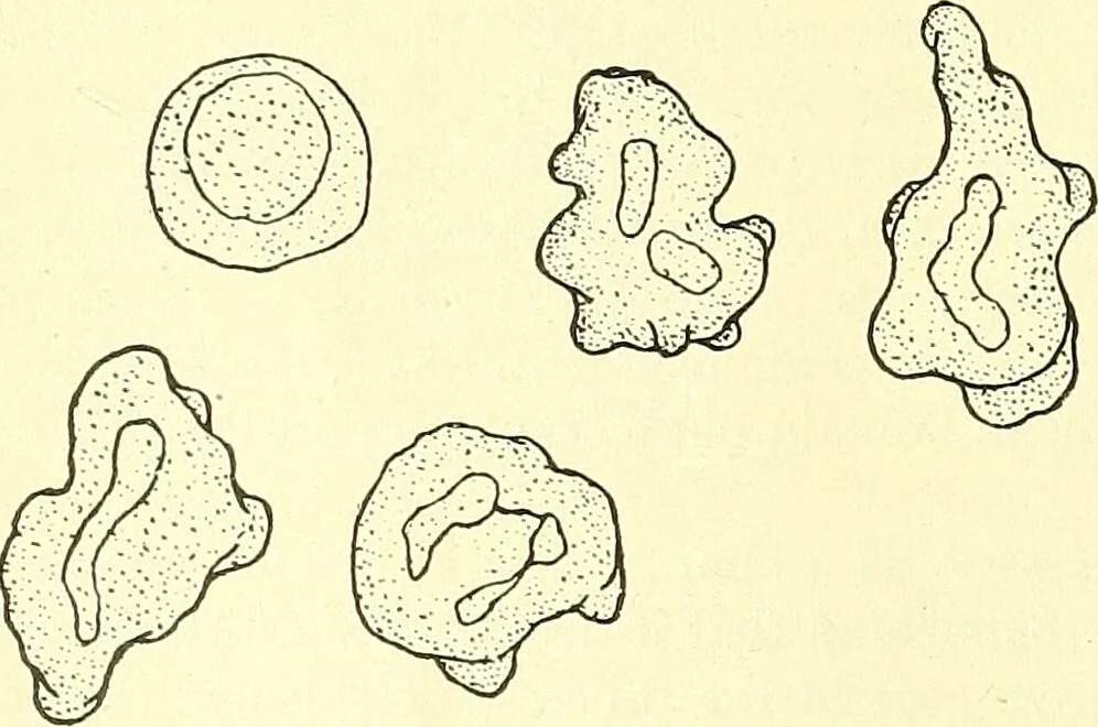 An illustration from Modern surgery, general and operative / by John Chalmers Da Costa., 1907, leaf 84