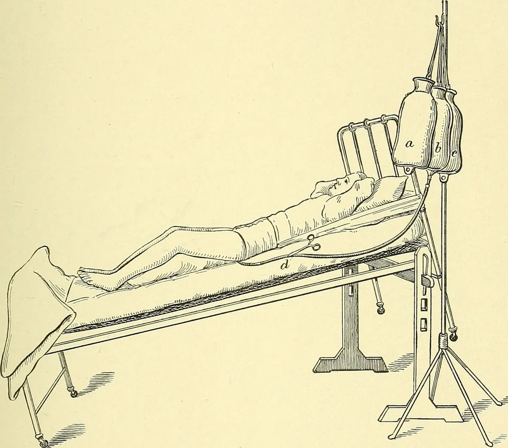 An illustration from Modern surgery, general and operative / by John Chalmers Da Costa., 1907, leaf 891