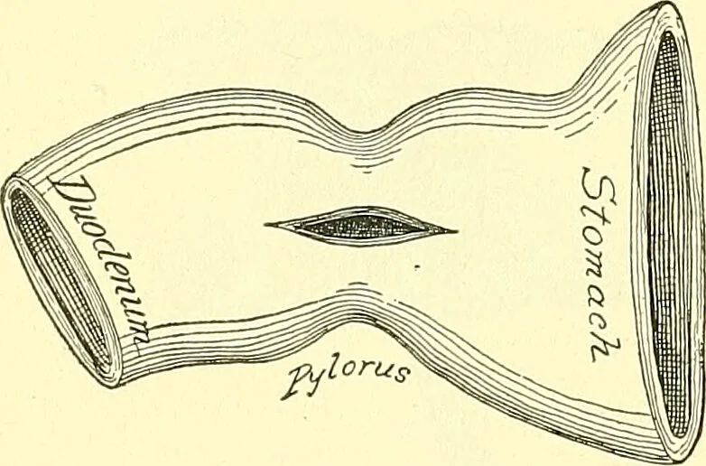 An illustration from Modern surgery, general and operative / by John Chalmers Da Costa., 1907, leaf 946