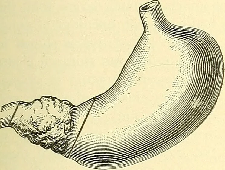An illustration from Modern surgery, general and operative / by John Chalmers Da Costa., 1907, leaf 949
