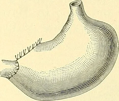 An illustration from Modern surgery, general and operative / by John Chalmers Da Costa., 1907, leaf 949