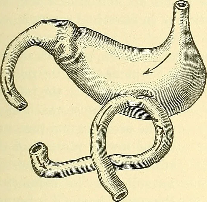 An illustration from Modern surgery, general and operative / by John Chalmers Da Costa., 1907, leaf 957